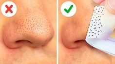 22-EASY-WAYS-TO-REMOVE-BLACKHEADS-FAST-FACE