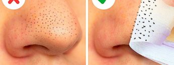 22-EASY-WAYS-TO-REMOVE-BLACKHEADS-FAST-FACE