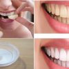 An amazing solution for cleaning your teeth