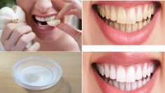 An amazing solution for cleaning your teeth