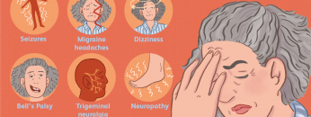 Symptoms of a stroke
