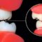 17 ترفند برای مراقبت از دندانها